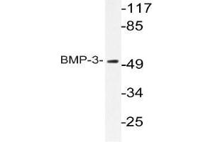 Western blot (WB) analyzes of BMP-3 antibody in extracts from HeLa cells. (BMP3 Antikörper)