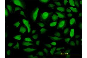 Immunofluorescence of monoclonal antibody to RRM2 on HeLa cell. (RRM2 Antikörper  (AA 1-110))