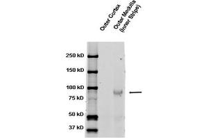 Western blot analysis of Rat kidney tissue lysates showing detection of ENaC protein using Rabbit Anti-ENaC Polyclonal Antibody . (SCNN1A Antikörper  (AA 617-638) (FITC))