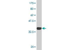 Western Blot detection against Immunogen (36. (TBX3 Antikörper  (AA 311-410))