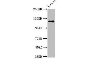 Western Blot Positive WB detected in: Jurkat whole cell lysate All lanes: SREBF1 antibody at 5. (SREBF1 Antikörper  (AA 38-201))