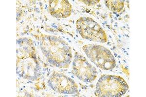 Immunohistochemistry of paraffin-embedded Mouse stomach using SULT2A1 Polyclonal Antibody at dilution of 1:200 (40x lens). (SULT2A1 Antikörper)