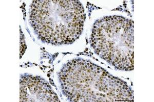 IHC analysis of MBNL1 using anti-MBNL1 antibody (ABIN7602608). (MBNL1 Antikörper  (AA 89-388))