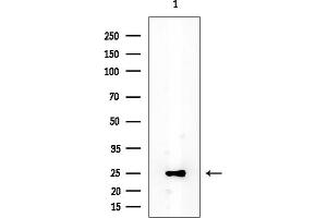 anti-Dicarbonyl/L-Xylulose Reductase (DCXR) antibody