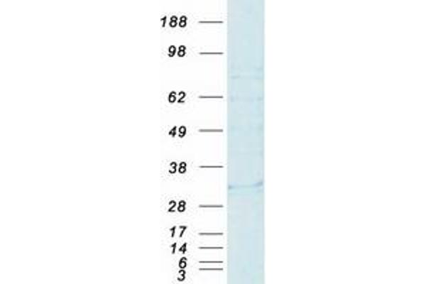 HLA-DMB Protein (Myc-DYKDDDDK Tag)