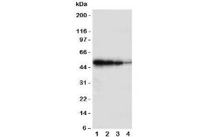 Western blot testing of BMPR1B antbody;  Lane 1: Recombinant human protein 10ng;  2: 5ng;  3: 2. (BMPR1B Antikörper  (Middle Region))