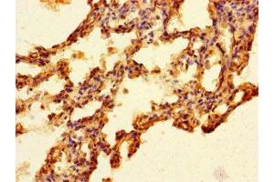 Immunohistochemistry of paraffin-embedded human lung tissue using ABIN7165390 at dilution of 1:100 (FAM131A Antikörper  (AA 1-281))