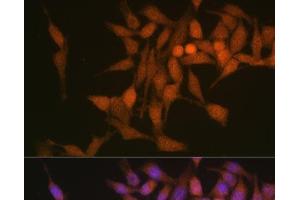 Immunofluorescence analysis of HeLa cells using PSMB6 Polyclonal Antibody at dilution of 1:100 (40x lens). (PSMB6 Antikörper)