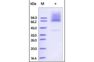 Human Glypican 3, His Tag on SDS-PAGE under reducing (R) condition. (Glypican 3 Protein (GPC3) (AA 25-559) (His tag))