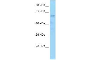 WB Suggested Anti-ZNF20 Antibody Titration: 1.