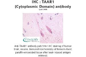 Image no. 1 for anti-Trace Amine Associated Receptor 1 (TAAR1) (3rd Cytoplasmic Domain) antibody (ABIN1739854) (TAAR1 Antikörper  (3rd Cytoplasmic Domain))