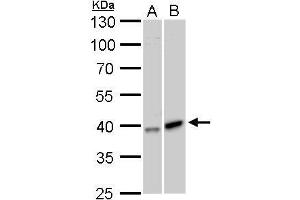 WB Image GALK1 antibody detects GALK1 protein by Western blot analysis.