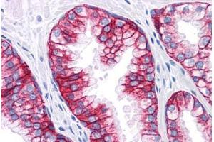 Human Prostate: Formalin-Fixed, Paraffin-Embedded (FFPE) (EpCAM Antikörper)