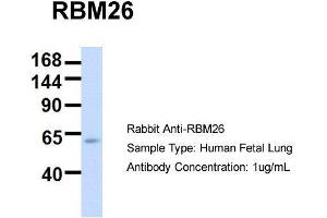 Host:  Rabbit  Target Name:  RBM26  Sample Type:  Human Fetal Lung  Antibody Dilution:  1. (RBM26 Antikörper  (Middle Region))