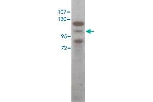 Western blot using Stat5a polyclonal antibody  shows detection of Stat5a protein in HeLa cell extract (arrowhead). (STAT5A Antikörper  (C-Term))