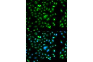 Immunofluorescence analysis of A549 cells using ELF5 antibody. (ELF5 Antikörper)
