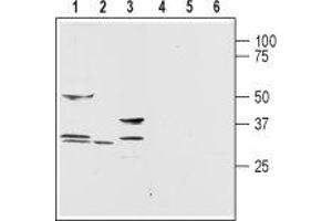 Western blot analysis of rat brain (lanes 1 and 4), testis (lanes 2 and 5) and liver (lanes 3 and 6) membranes:1,2,3.