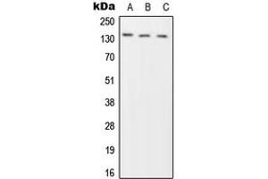 Western blot analysis of Phogrin expression in HeLa (A), SP2/0 (B), H9C2 (C) whole cell lysates. (PTPRN2 Antikörper  (Center))