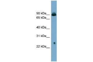 Western Blotting (WB) image for anti-Solute Carrier Family 6 (Neurotransmitter Transporter, Glycine), Member 5 (SLC6A5) (Middle Region) antibody (ABIN2781603)