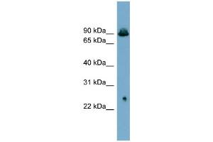 WB Suggested Anti-SLC6A5  Antibody Titration: 0. (SLC6A5 Antikörper  (Middle Region))