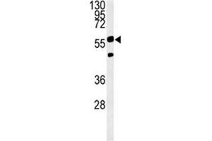 PHGDH antibody western blot analysis in Ramos lysate. (PHGDH Antikörper  (AA 249-277))