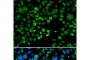 Immunofluorescence analysis of MCF-7 cells using TXNDC5 Polyclonal Antibody