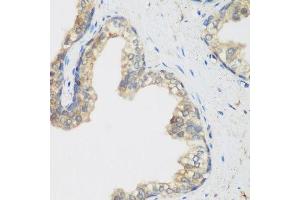 Immunohistochemistry of paraffin-embedded human prostate using NCBP2 antibody. (NCBP2 Antikörper  (AA 1-156))