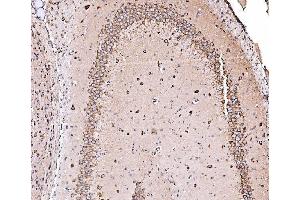 IHC analysis of ORP150/HYOU1 using anti-ORP150/HYOU1 antibody (ABIN7601807).