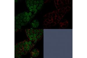 Confocal immunofluorescence image of MCF-7 cells using CHD4 Mouse Monoclonal Antibody (3F2/4) stained in Green (CF488) and Phalloidin is used to label the membranes.