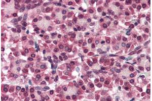 Human Pancreas (formalin-fixed, paraffin-embedded) stained with GPC4 antibody ABIN351425 at 5-10 ug/ml followed by biotinylated goat anti-rabbit IgG secondary antibody ABIN481713, alkaline phosphatase-streptavidin and chromogen. (GPC4 Antikörper  (Internal Region))