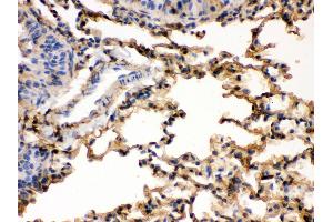 Immunohistochemistry (Paraffin-embedded Sections) (IHC (p)) image for anti-S100 Calcium Binding Protein A6 (S100A6) (AA 1-90) antibody (ABIN3043320) (S100A6 Antikörper  (AA 1-90))