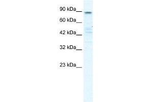 WB Suggested Anti-KCNQ2 Antibody Titration:  0. (KCNQ2 Antikörper  (N-Term))