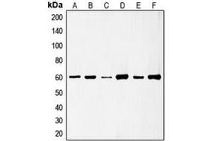 Western blot analysis of c-SRC (pS75) expression in HeLa (A), HuvEc (B), Jurkat (C), COLO205 (D), HEK293T EGF-treated (E), A431 pervanadate-treated (F) whole cell lysates. (Src Antikörper  (N-Term, pSer75))