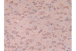 IHC-P analysis of Mouse Cerebrum Tissue, with DAB staining. (CD38 Antikörper  (AA 54-301))