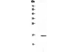 Western blot analysis of Niemann Pick C2 using anti-Niemann Pick C2 antibody . (NPC2 Antikörper)