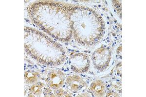 Immunohistochemistry of paraffin-embedded human stomach using CPM antibody at dilution of 1:100 (x40 lens). (CPM Antikörper)