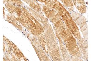 ABIN6274975 at 1/100 staining human skeletal muscle tissue sections by IHC-P. (CPT1B Antikörper  (Internal Region))
