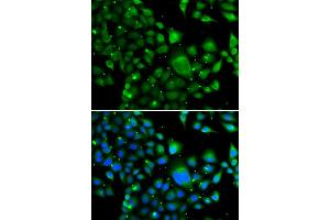 Immunofluorescence analysis of MCF-7 cells using WBSCR22 antibody (ABIN4905616). (WBSCR22 Antikörper)