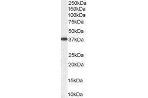 Western Blotting (WB) image for Aldo-Keto Reductase Family 1, Member B1 (Aldose Reductase) (AKR1B1) peptide (ABIN370286) (Aldo-Keto Reductase Family 1, Member B1 (Aldose Reductase) (AKR1B1) Peptid)