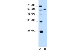 Western Blotting (WB) image for anti-Lamin B2 (LMNB2) antibody (ABIN2462974) (Lamin B2 Antikörper)