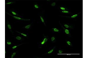 Immunofluorescence of purified MaxPab antibody to MLLT1 on HeLa cell.