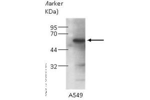 WB Image Sample (30 ug of whole cell lysate) A: 293T B: HepG2, C: Molt-4 , 7. (KPNA4 Antikörper  (C-Term))