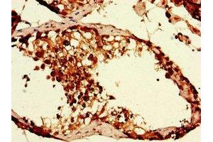 Immunohistochemistry of paraffin-embedded human testis tissue using ABIN7152373 at dilution of 1:100 (CAPZA1 Antikörper  (AA 211-252))