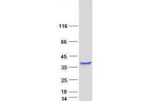 Western Blotting (WB) image for Engulfment and Cell Motility 1 (ELMO1) (Transcript Variant 3) protein (Myc-DYKDDDDK Tag) (ABIN2720143)