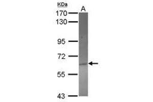 Image no. 1 for anti-Acyl-CoA Thioesterase 12 (ACOT12) (AA 290-537) antibody (ABIN1496413) (ACOT12 Antikörper  (AA 290-537))