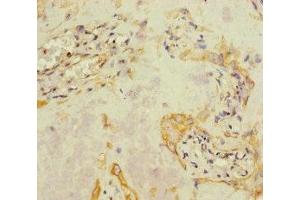 Immunohistochemistry of paraffin-embedded human placenta tissue using ABIN7157836 at dilution of 1:100 (A4GALT Antikörper  (AA 244-353))