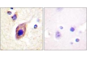 Immunohistochemistry analysis of paraffin-embedded human brain tissue, using PLCG2 (Ab-1217) Antibody. (Phospholipase C gamma 2 Antikörper  (AA 1186-1235))