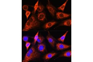 Immunofluorescence analysis of NIH-3T3 cells using PS Rabbit pAb (ABIN6132524, ABIN6146286, ABIN6146288 and ABIN6222421) at dilution of 1:100 (40x lens). (PSAT1 Antikörper  (AA 1-370))