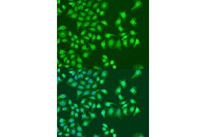 Immunofluorescence analysis of U2OS cells using NIN antibody (ABIN6291434) at dilution of 1:100. (Ninein Antikörper)