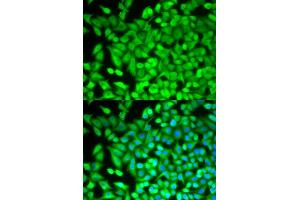 Immunofluorescence analysis of MCF-7 cells using FBP1 antibody (ABIN5973135). (FBP1 Antikörper)
